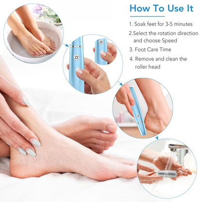 ??Hot Sale - 50% OFF??Electric Feet Callus Remover?