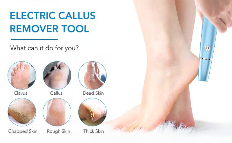 ??Hot Sale - 50% OFF??Electric Feet Callus Remover?